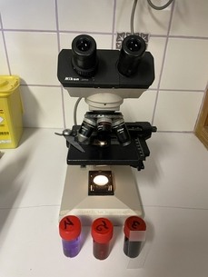 Le microscope permet de visualiser rapidement les échantillons récoltés (cérumens, exsudas, urines, etc)
